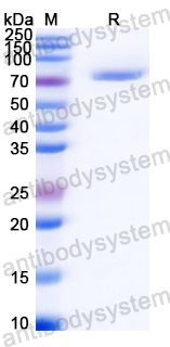 Recombinant Streptococcus suis IgdE1 Protein, N-GST & C-His