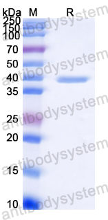 Recombinant Streptococcus agalactiae GBS Protein, C-His