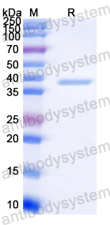 Recombinant Streptococcus agalactiae ADD Protein, N-His