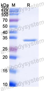 Recombinant Clostridium perfringens toxin NetB Protein, N-His