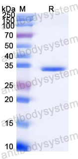 Recombinant Clostridium perfringens toxin NetB Protein, N-His
