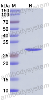 Recombinant Baker's yeast GPM1/PGAM 1 Protein, C-His