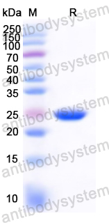 Recombinant European house dust mite DERP7/Der p 7 Protein, N-His