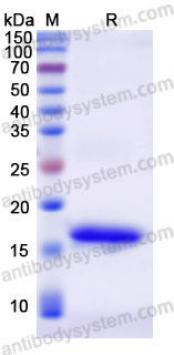 Recombinant European house dust mite Der p 2/DERP2 Protein, N-His