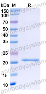 Recombinant Plasmodium relictum MSP1 Protein, N-His