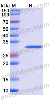 Recombinant Rice Putative receptor protein kinase Protein, C-His