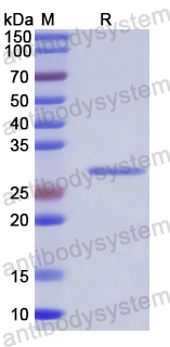 Recombinant Tomato YTHDC/101267743 Protein, N-His
