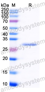 Recombinant Common timothy Phl p 5/Allergen Phl p V Protein, N-His