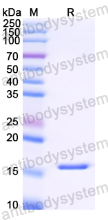 Recombinant Betula pendula BETVII/Allergen Bet v II Protein, N-His