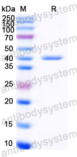 Recombinant Common timothy Phl p 6/PHLPVI Protein, N-GST & C-His