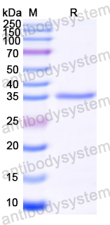 Recombinant Common timothy Phl p 7/PHLPVII Protein, N-GST & C-His